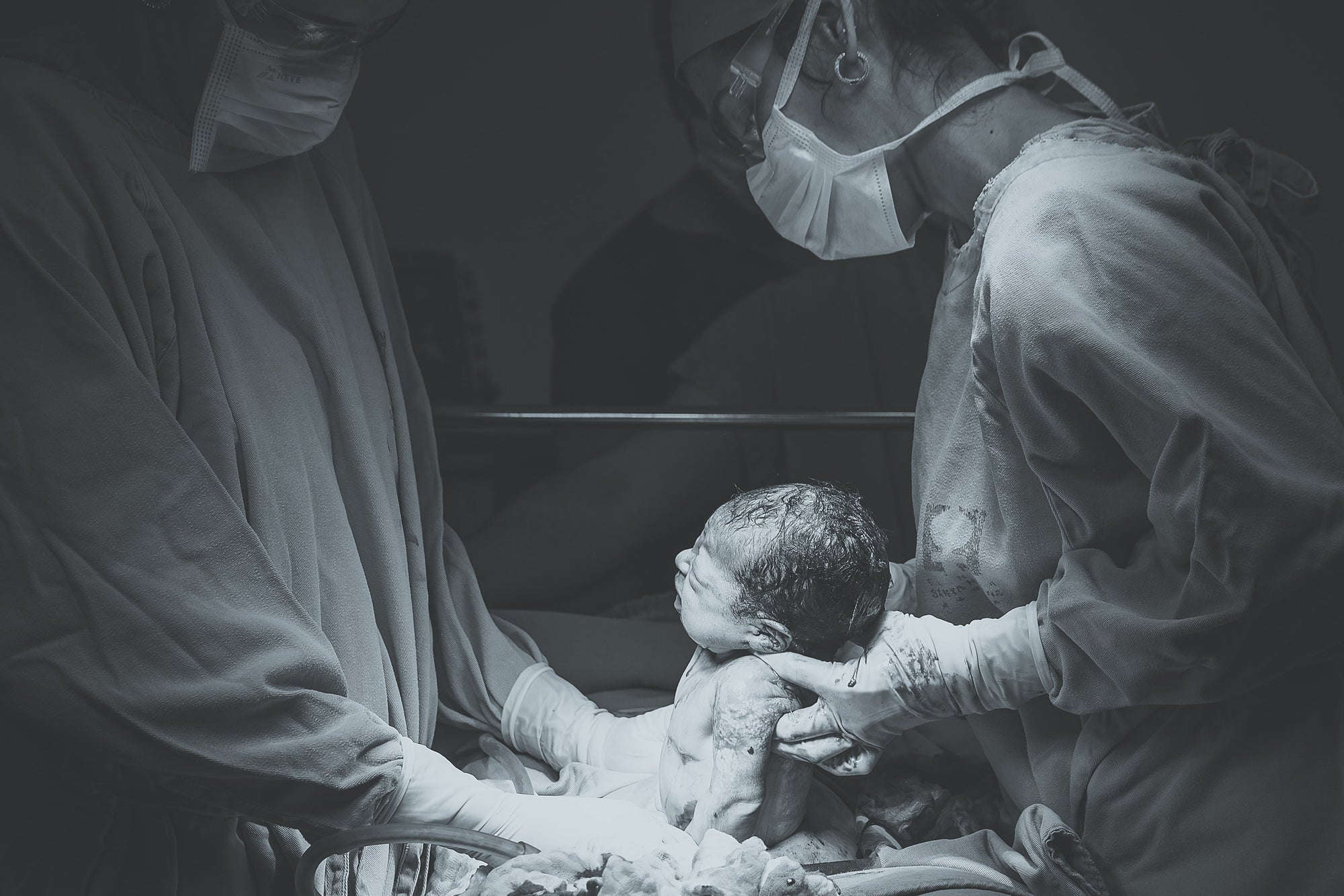 Everything You Need to Know About a Gentle C-section